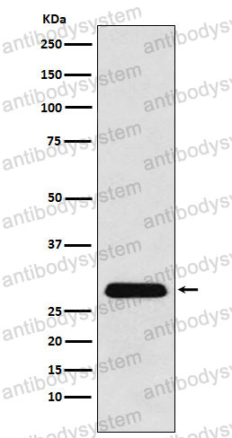 Anti-PGAM1/PGAM-B Antibody (R1Q92)
