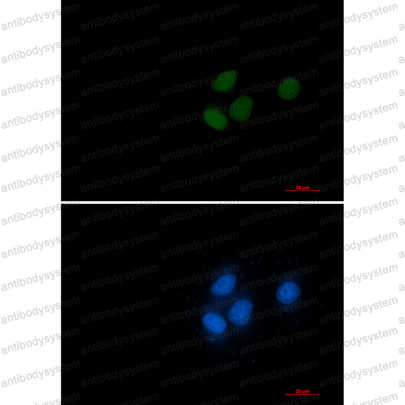 Anti-RCC1 Antibody (R1Q94)