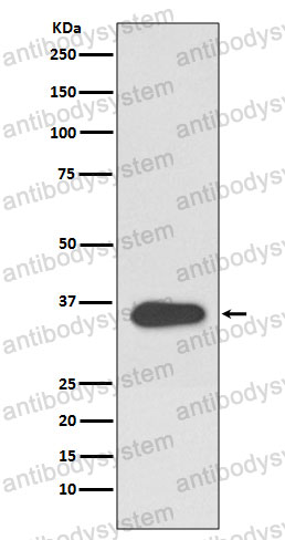 Anti-ATF1 Antibody (R1Q95)