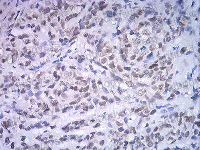 Anti-ATF4/CREB2 Antibody (R3F06)