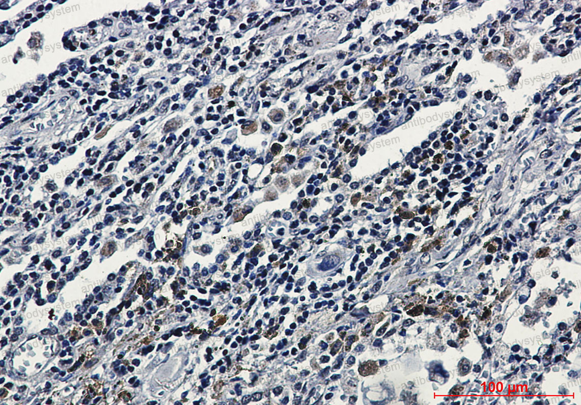 Anti-ATF6 Antibody (R1Q98)
