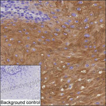 Anti-KRT4 Antibody (R3F11)