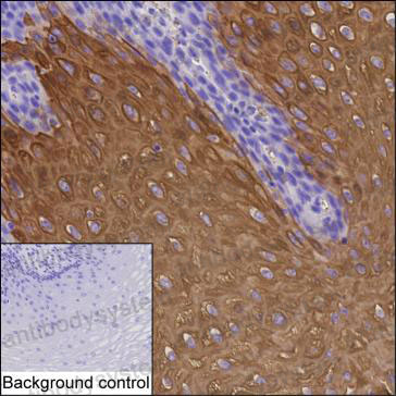 Anti-KRT4 Antibody (R3F12)