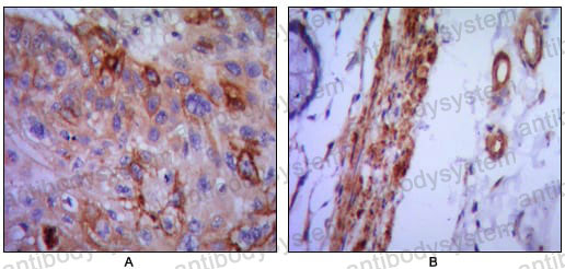 Anti-CD106/VCAM1 Antibody (R3F20)