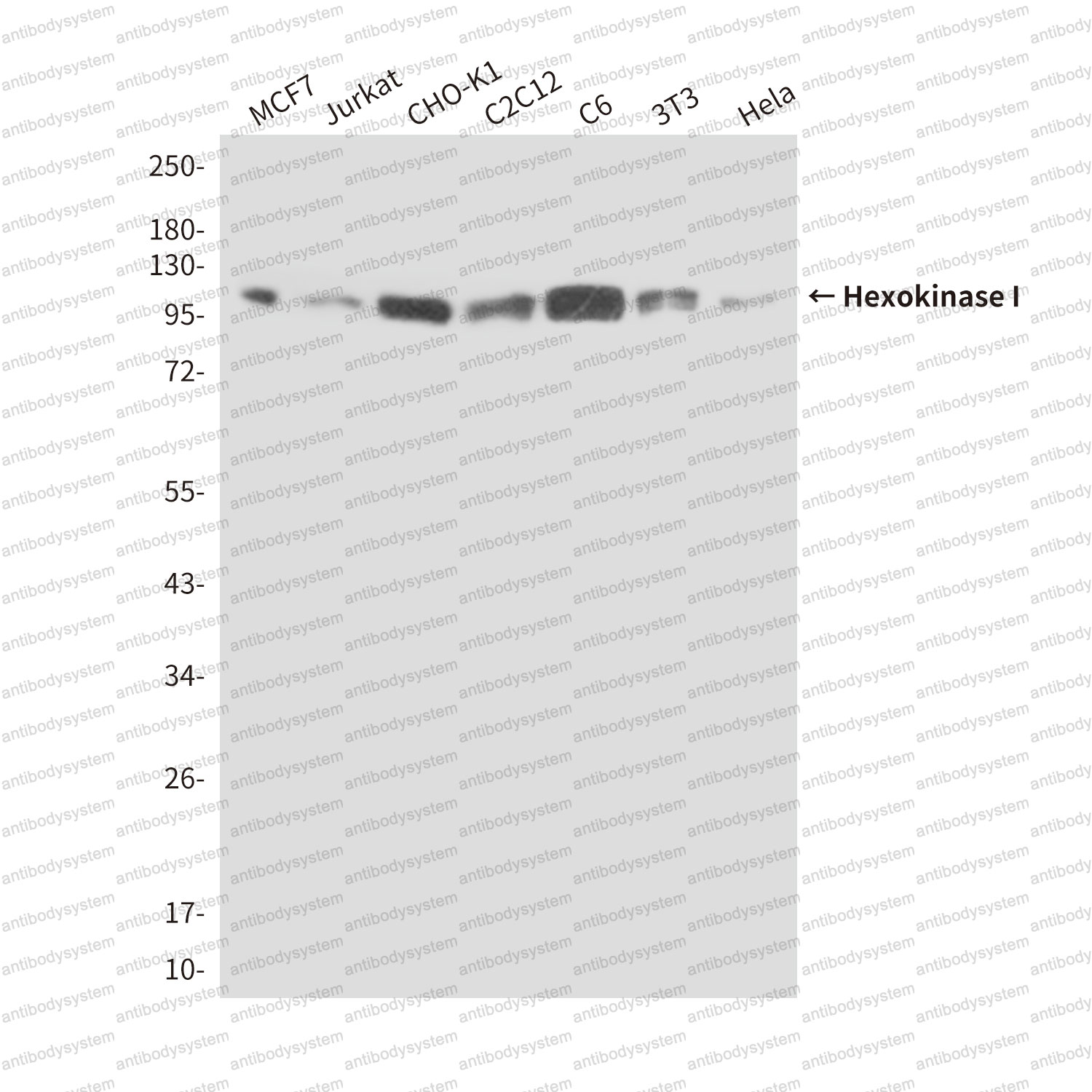 Anti-HK1 Antibody (R3F25)