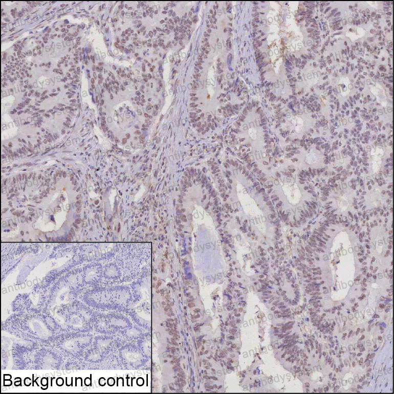 Anti-TFE3 Antibody (R3F39)
