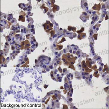 Anti-NCF2 Antibody (R3F46)