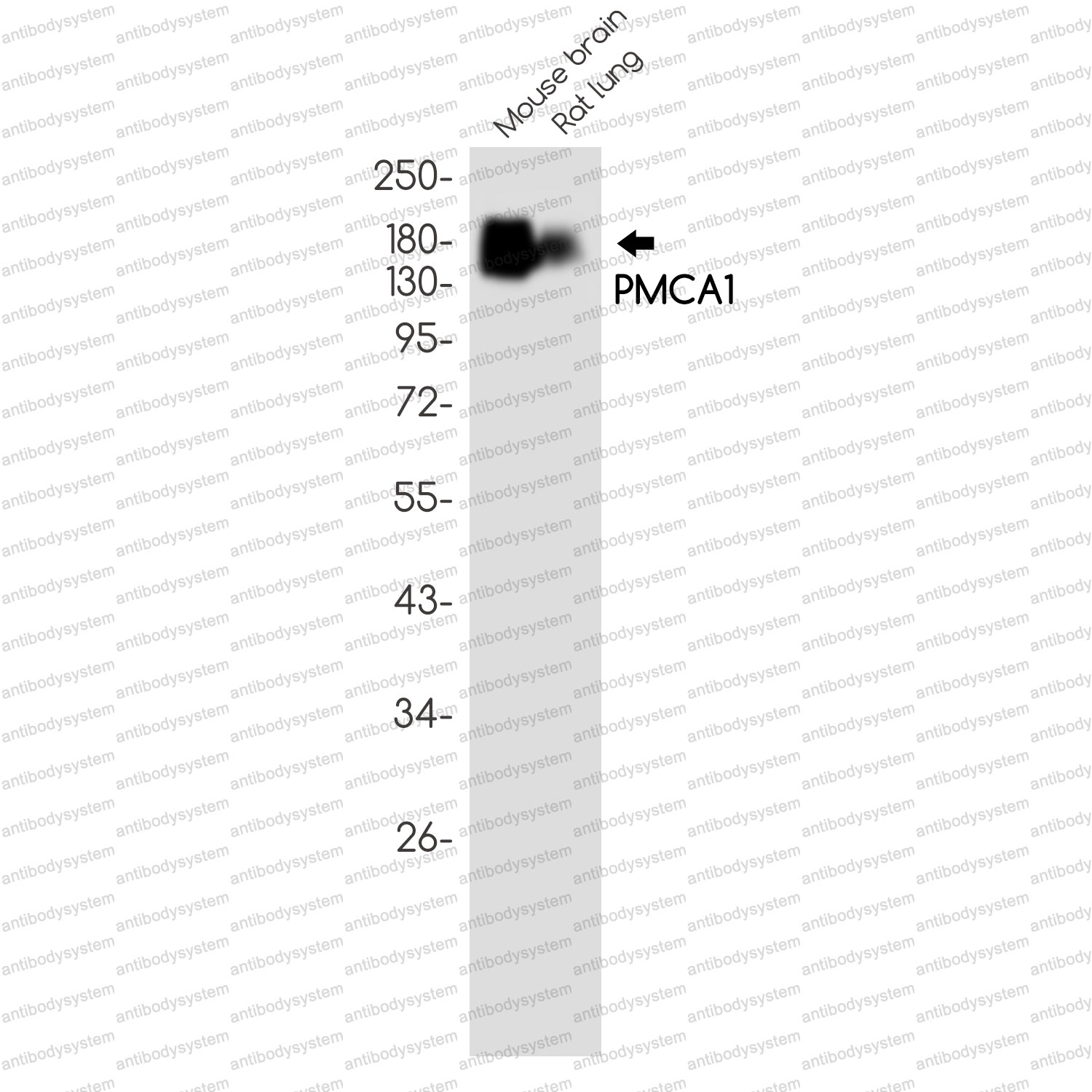Anti-ATP2B1 Antibody (R1R37)