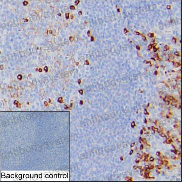 Anti-Human Kappa Light Chain Antibody (R3F49)