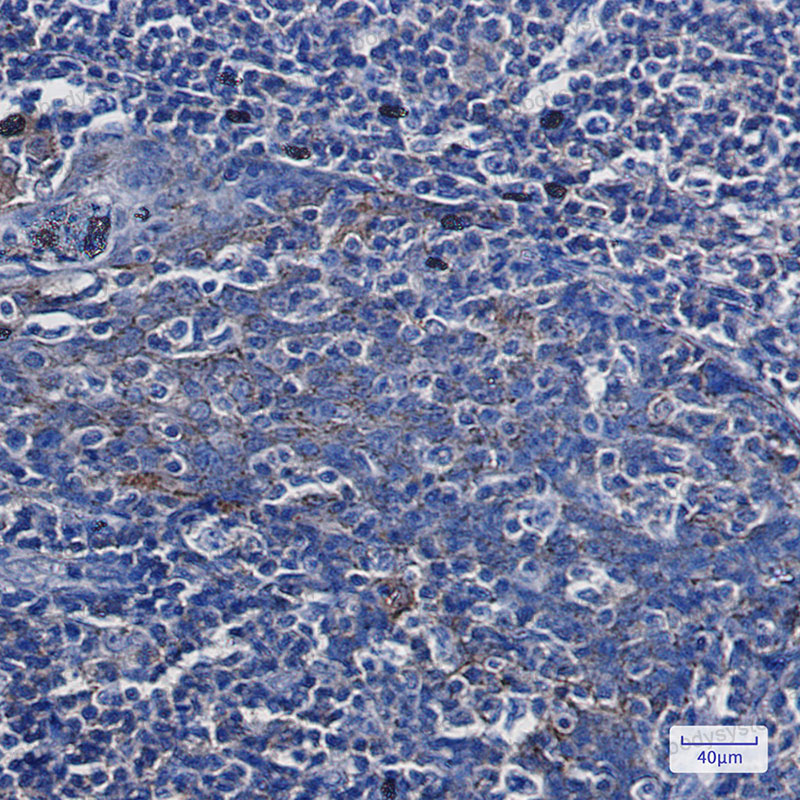 Anti-ANXA7 Antibody (R1R43)