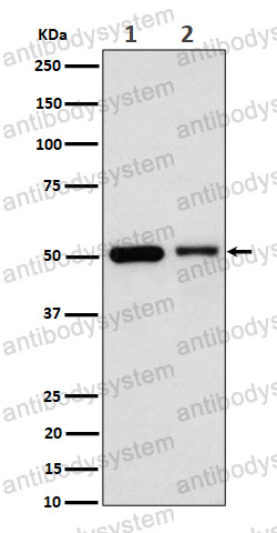Anti-ANXA7 Antibody (R1R41)