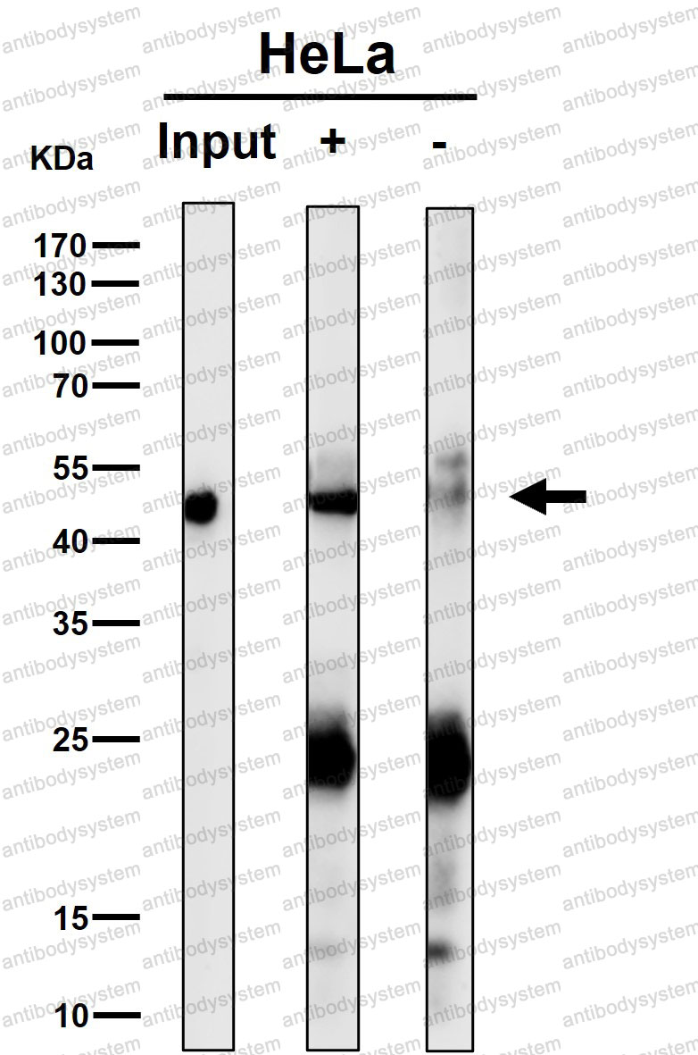Anti-ANXA7 Antibody (R1R42)