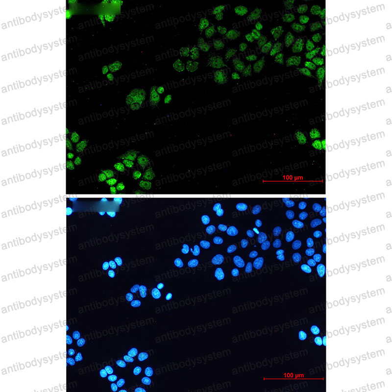 Anti-TBP Antibody (R1R44)