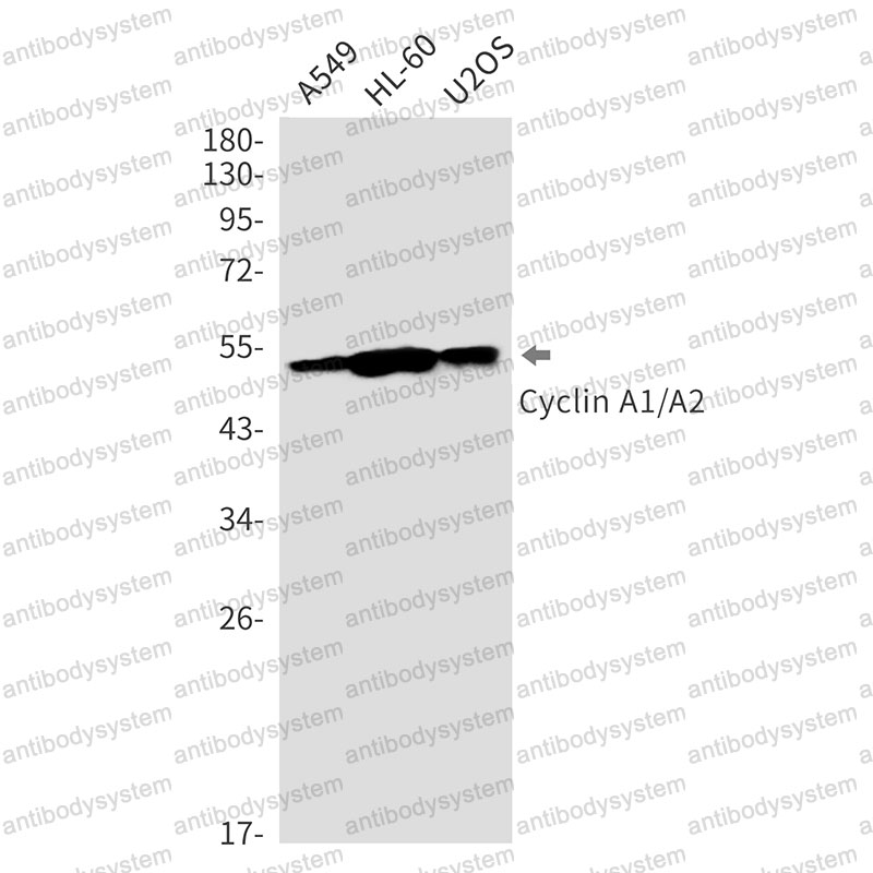 Anti-Cyclin A1/A2 Antibody (R1R50)