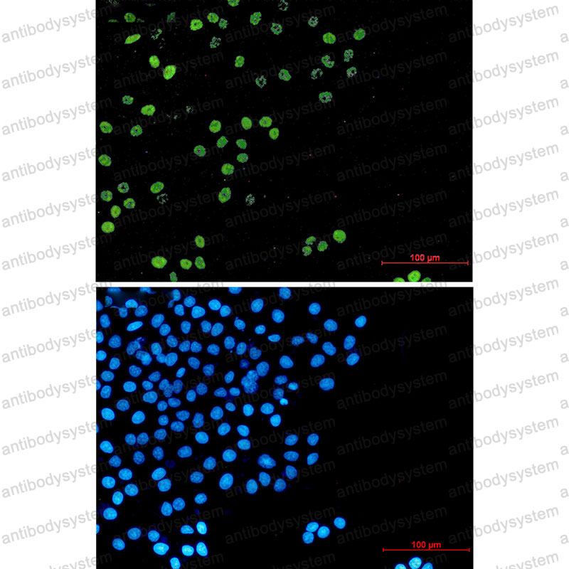 Anti-CCNA2 Antibody (R1R49)