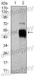 Anti-POU3F2 Antibody (R3F59)