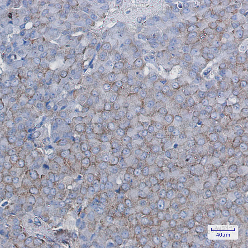 Anti-BTF3 Antibody (R1R52)