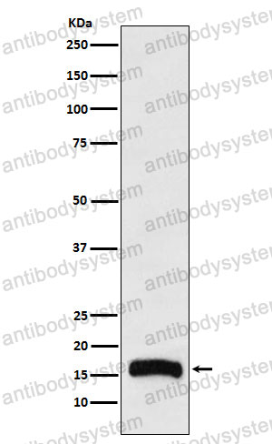 Anti-ALOX5AP Antibody (R1R53)