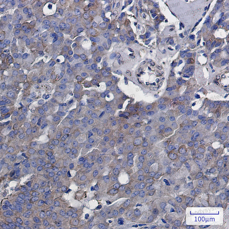 Anti-RAB5A Antibody (R1R55)
