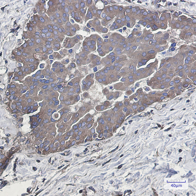 Anti-RAB5A Antibody (R1R54)