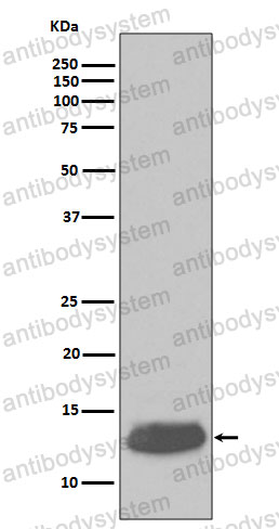 Anti-PVALB Antibody (R1R59)