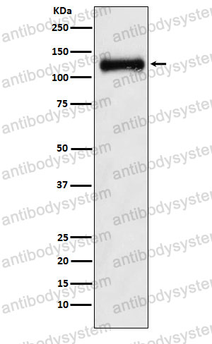 Anti-NPR2 Antibody (R1R60)