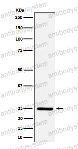 Anti-EFNA1 Antibody (R1R65)