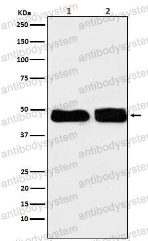 Anti-C4BPB Antibody (R1R66)