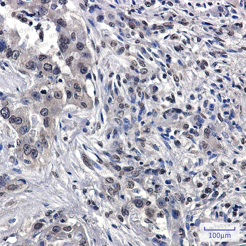 Anti-RASA1 Antibody (R1R70)