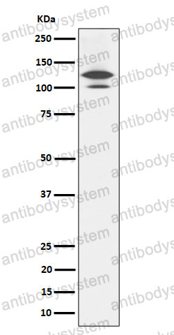 Anti-RASA1 Antibody (R1R69)