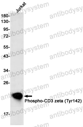 Anti-Phospho-CD247/CD3Z (Tyr142) Antibody (R1R71)