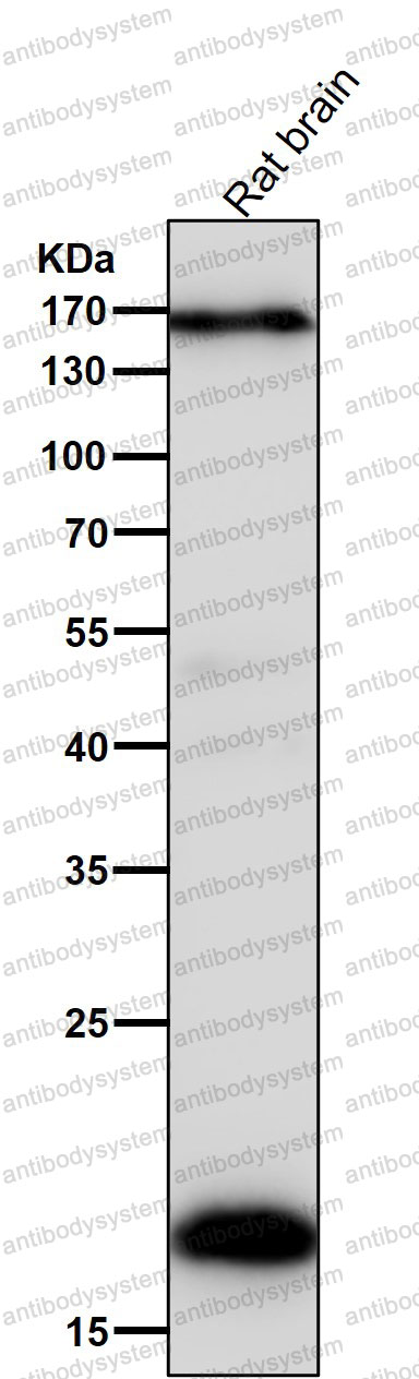 Anti-PTN Antibody (R1R72)