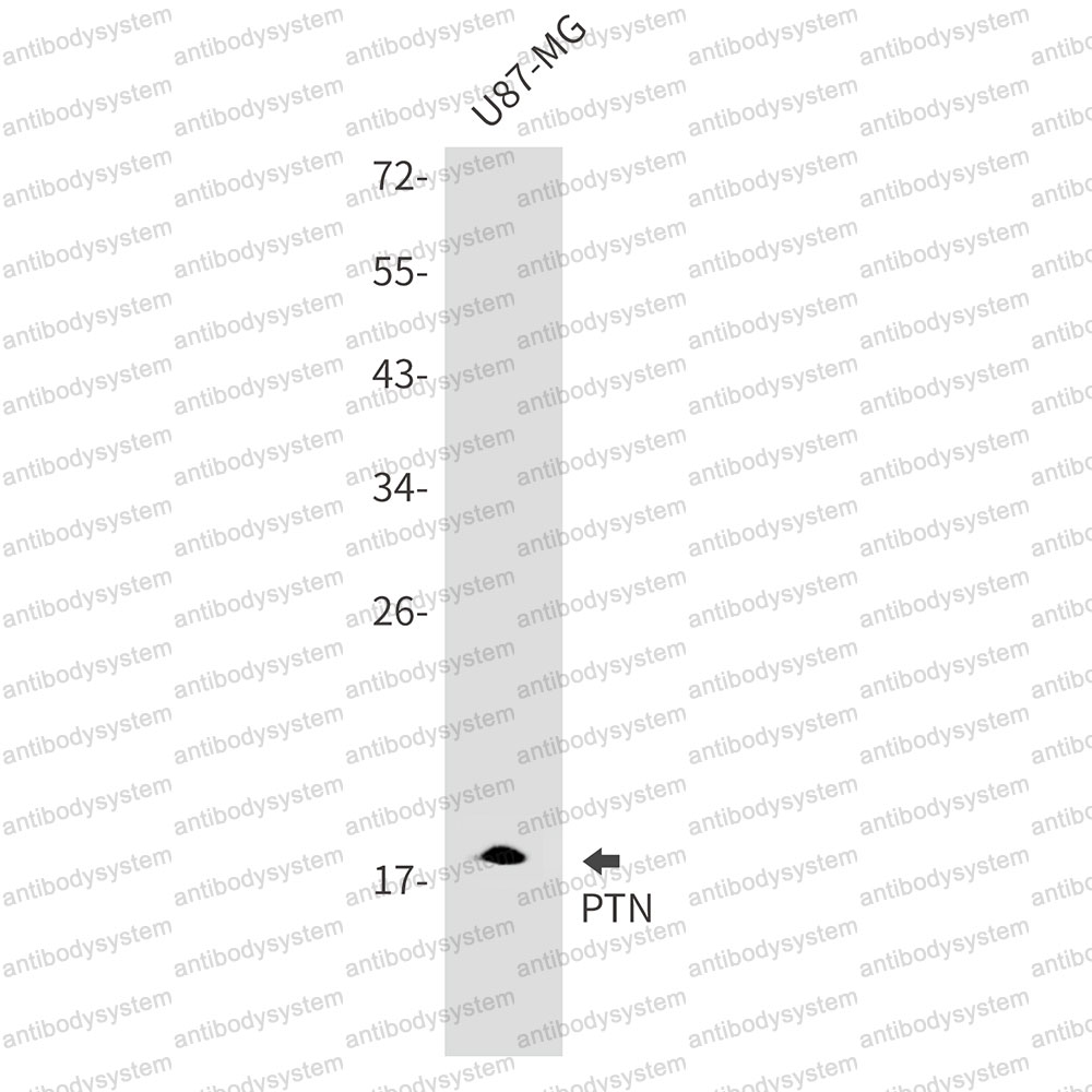 Anti-PTN Antibody (R1R73)