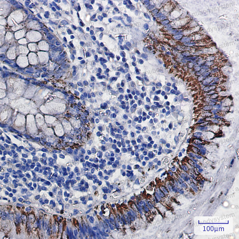 Anti-MAOA Antibody (R1R75)