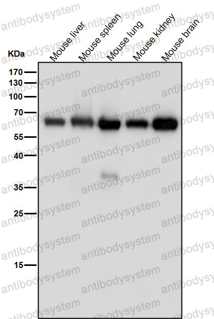 Anti-MAOA Antibody (R1R74)