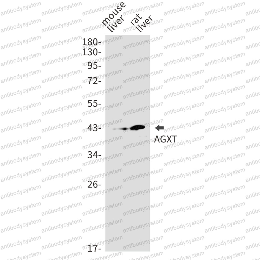 Anti-AGXT Antibody (R1R76)