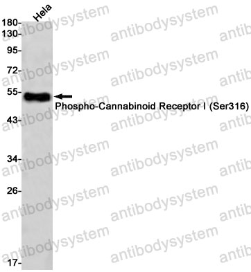 Anti-Phospho-CNR1/CB1 (Ser316) Antibody (R1R77)