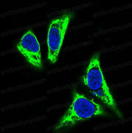 Anti-TNFAIP3 Antibody (R1R78)