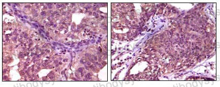 Anti-EPHA1 Antibody (R3F91)