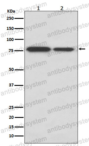 Anti-DRD1/AGIA Antibody (R1R81)