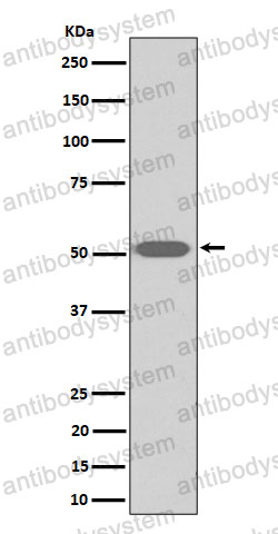 Anti-TBXA2R Antibody (R1R82)