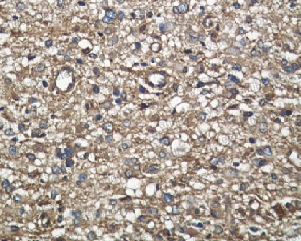 Anti-MDK/Midkine Antibody (R1C45)