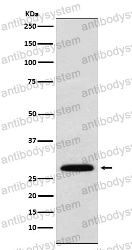 Anti-FGF7 Antibody (R1R84)