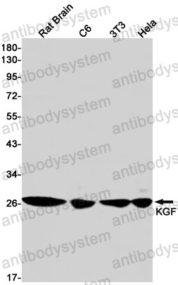 Anti-FGF7 Antibody (R1R85)