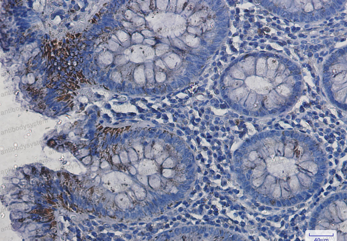 Anti-VDAC1 Antibody (R1R86)