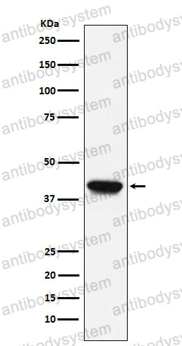 Anti-BGN Antibody (R1R88)