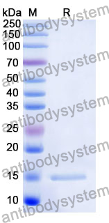 Anti-Human ERBB3/HER3 Nanobody (SAA1309)