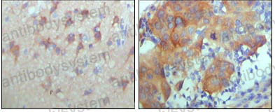Anti-ERBB3/HER3 Antibody (R3F96)