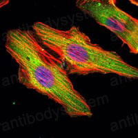 Anti-MATN1 Antibody (R3G02)