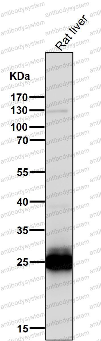 Anti-COMT Antibody (R1R90)